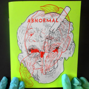 abnormal20cvr