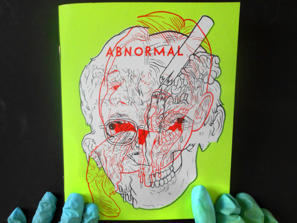 abnormal20cvr